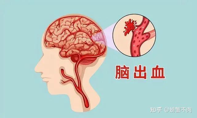 高血压的危害你注意了吗？